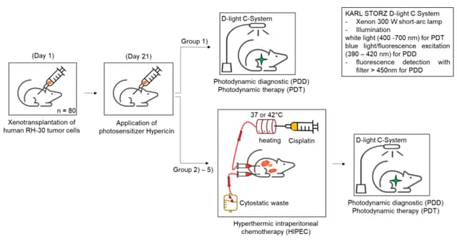 Increasing the efficiency of hyperthermic intraperitoneal chemotherapy (HIPEC) by a combination with a photosensitive drug in pediatric rhabdomyosarcoma
